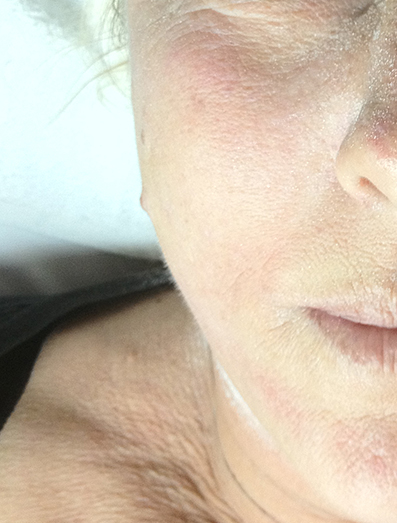 Rejuvenation - Bakersfield, CA